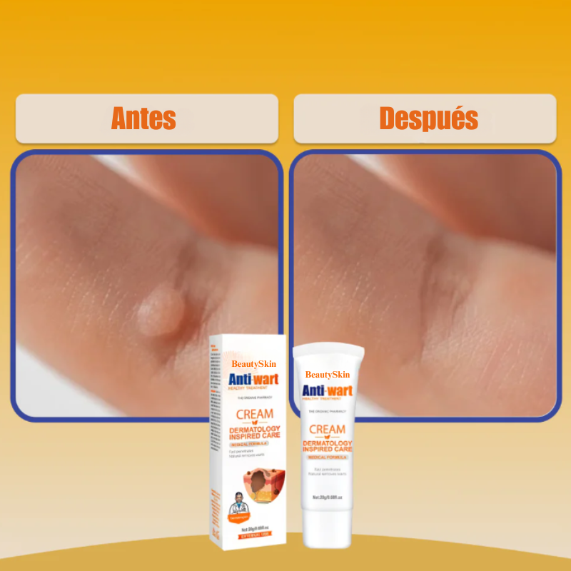 BEAUTYSKIN® | Removedor de Verrugas